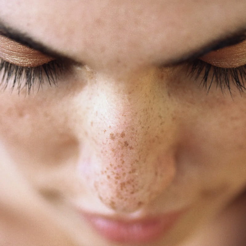 Pigmentation