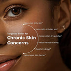 Herbal Skin Care Kit for Dry & Sensitive Skin